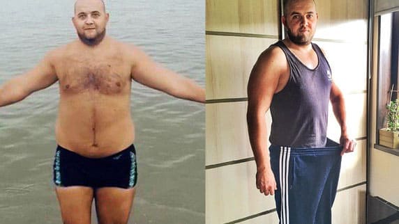 Hombre antes y después de Rhino Gold 1