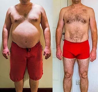 Hombre antes y después de Rhino Gold 4